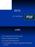 ECG Lecture