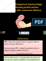 Secondary Postpartum Haemorrhage (PPH) Following Partial