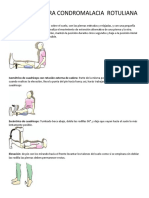 Ejercicios para Condromalacia Rotuliana