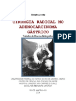 Cirurgia Radical No Adenocarcinoma Gástrico