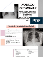 Nodulo Polmonar. .