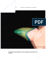 4 Capitulo - Enceramento de Infraestrutura para Prótese Fixa Unitária
