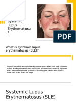 Systemic Lupus Erythematosus