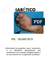 Pie Diabetico