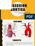 Diseccion Aortica