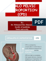 Cephalo Pelvic Disproportion