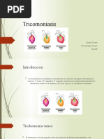 Tricomoniasis