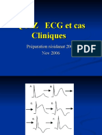 Insuffisance Coronaire Et Infarctus de Myocarde. (4) ECG