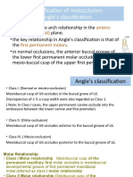 Classification of Malocclusion Angle's Classification: Antero-Posterior (Sagittal) First Permanent Molars