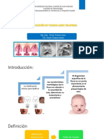 Clasificacion de Las Fisuras Labio Palatinas Ultimo