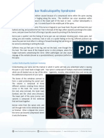 Lumbar Radiculopathy Syndrome