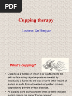 Cupping Therapy: Lecturer: Qu Hongyan