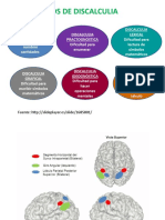 DISCALCULIA