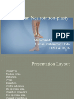 Van Nes Rotation-Plasty-1