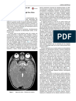 Ciliopatías PDF