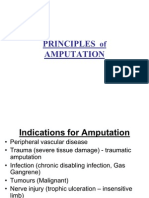 Amputation