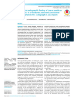 Incidental Radiographic Finding of Charm Needle or "Susuk" in Orthodontic Panoramic and Lateral Cephalometric Radiograph: A Case Report