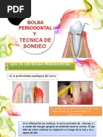 Bolsa Periodontal y Tecnica de Sondeo