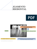 Analisis Radiografico Perio