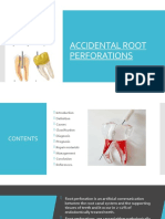 Accidental Root Perforations