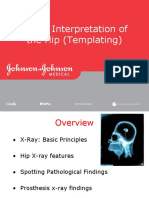 X-Ray Interpretation of The Hip