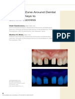 The Gray Zone Around Dental Implants - Keys To Esthetic Success