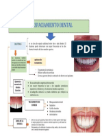 Espaciamiento Dental: Opciones de Tratamiento