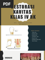 Kavitas Kelas 4 RESIN KOMPOSIT