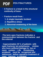 Open Fractures