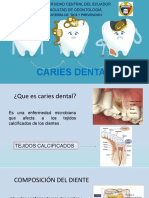 Caries Dental Grupo 5