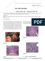 Congenital Scalp Tumor With Ulceration: Jeremy Udkoff MA, MAS - Ralph E. Holmes MD - Magdalene A. Dohil MD