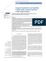 Nonsurgical Treatment and Stability of An Adult With A Severe Anterior Open Bite Malocclusion