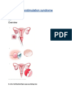 Ovarian Hyperstimulation Syndrome