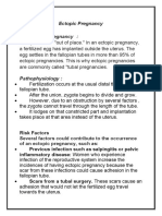 Ectopic Pregnancy