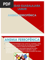 Anemia Ferropenica