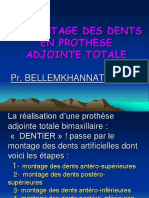 LE MONTAGE DES DENTS EN PROTHESE ADJOINTE TOTALE. Pr. BELLEMKHANNATE Samira