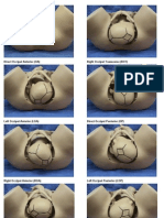 Direct Occiput Anterior (OA) Right Occiput Transverse (ROT)