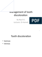 Management of Tooth Discoloration