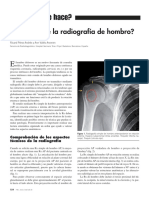 ¿Cómo Se Lee La Radiografía de Hombro?