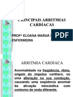 3.principais Arritmias Cardíacas