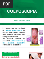 Colposcopia - Ochoa Mendoza Jhons