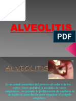 Pericoronitis y Alveolitis