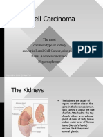 Renal Cell Carcinoma