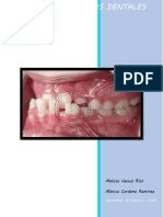 Anomalias Dentales