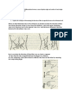 What Are The Criteria of Differentiation Between A Mass of Splenic Origin and Another of Renal Origin On Physical Examination?