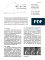 Mixed Periapical Lesion: An Atypical Radicular Cyst With Extensive Calcifications