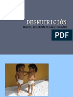 DESNUTRICIÓN