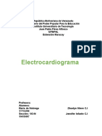 Trabajo de Electrocardiograma