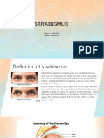 Strabismus: Name: Kholilah NPM: 19360190