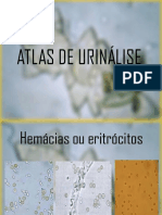 Atlas de Urinalise